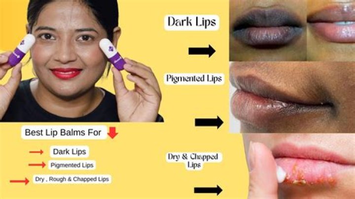Which lip balm is best for kissing?