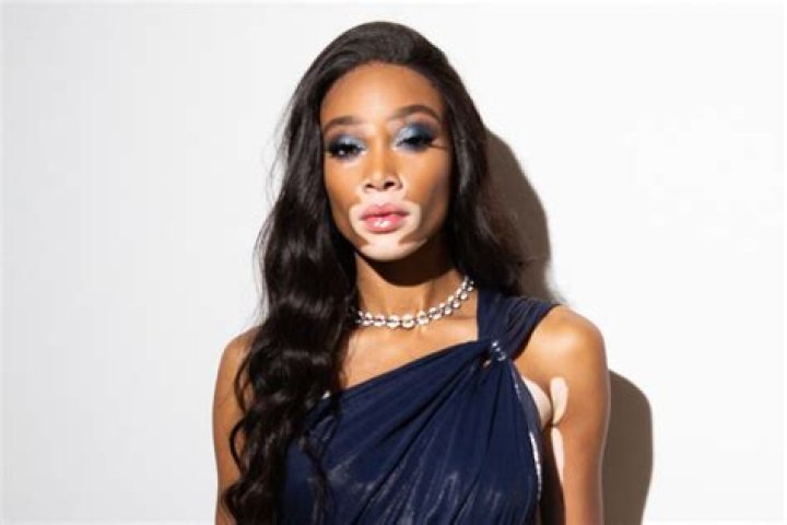 Winnie Harlow is the latest Amazonian model to join the Victoria's Secret girl gang | London Evening Standard